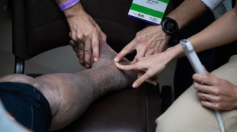 19º Congresso Brasileiro de Hansenologia - 2º Dia