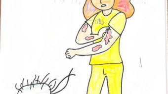 Campanha nacional Todos contra a Hanseníase - Foz do Iguaçu