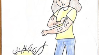 Campanha nacional Todos contra a Hanseníase - Foz do Iguaçu