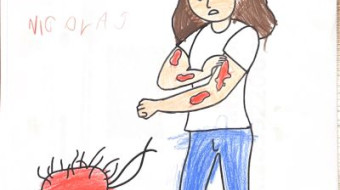 Campanha nacional Todos contra a Hanseníase - Foz do Iguaçu