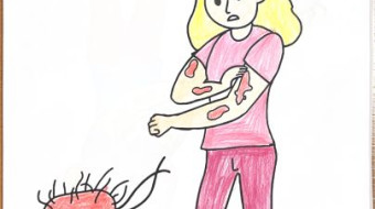 Campanha nacional Todos contra a Hanseníase - Foz do Iguaçu