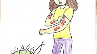 Campanha nacional Todos contra a Hanseníase - Foz do Iguaçu