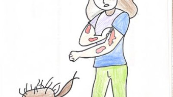 Campanha nacional Todos contra a Hanseníase - Foz do Iguaçu