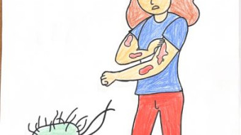 Campanha nacional Todos contra a Hanseníase - Foz do Iguaçu