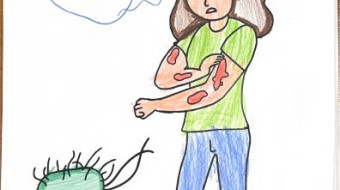 Campanha nacional Todos contra a Hanseníase - Foz do Iguaçu